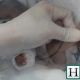 Jorge, the Peruvian premature baby of only 580 grams that exceeded Covid-19